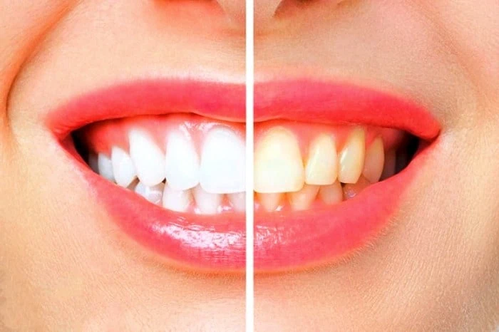 تاثیر رژیم غذایی بر سلامت دندان و لثه
