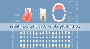 انواع دندان های دائمی در انسان