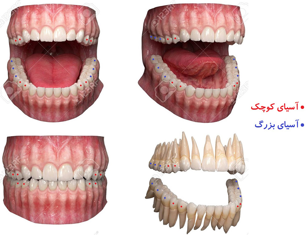 معرفی انواع دندان های دائمی