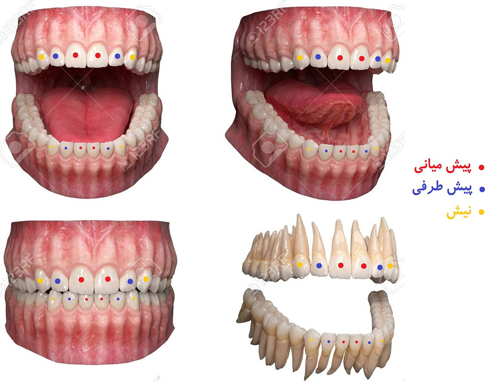 معرفی انواع دندان های دائمی