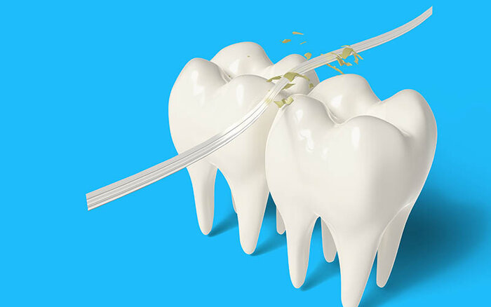 نخ دندان؛ راز پیشگیری از پوسیدگی و بیماری لثه