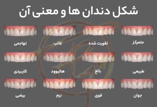 شخصیت‌شناسی از روی شکل دندان‌ها